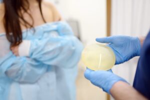 Breast Augmentation (Implants)