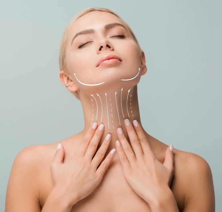Neck Lift