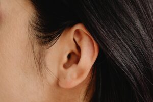 Otoplasty (Ear Reshaping)